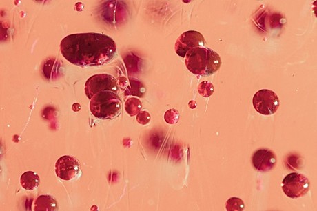 Программа для органов кроветворения